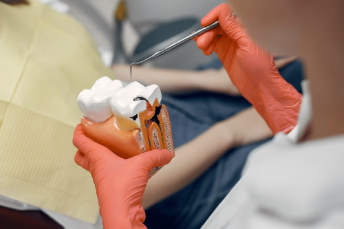 Tooth Extractions